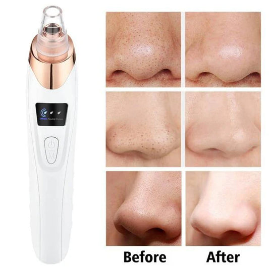 Facial Beauty - 5 in 1 Blackhead Remover Machine